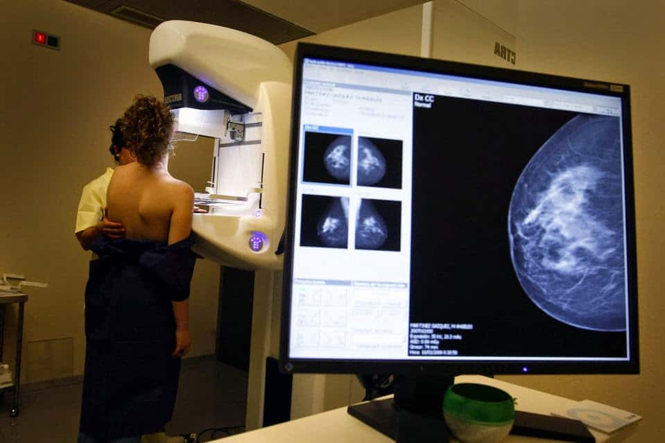 La tasa mundial de cáncer aumentó más de un tercio en diez años indica la Universidad de Washington