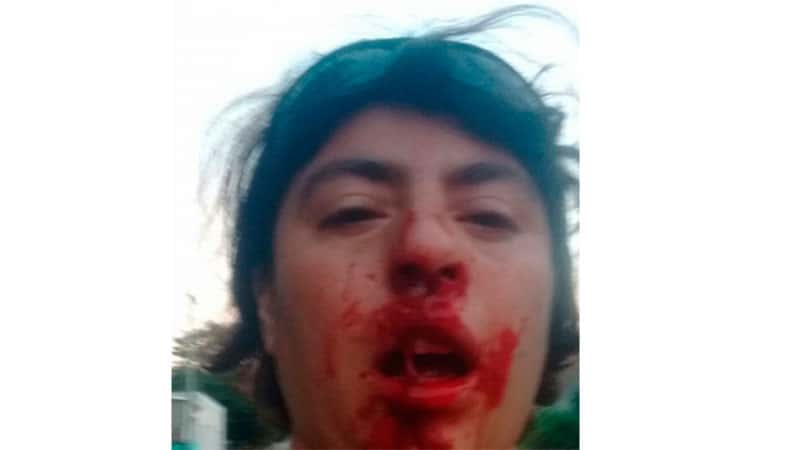 Una mujer fue brutalmente golpeada en Diamante: acusó a un empleado municipal