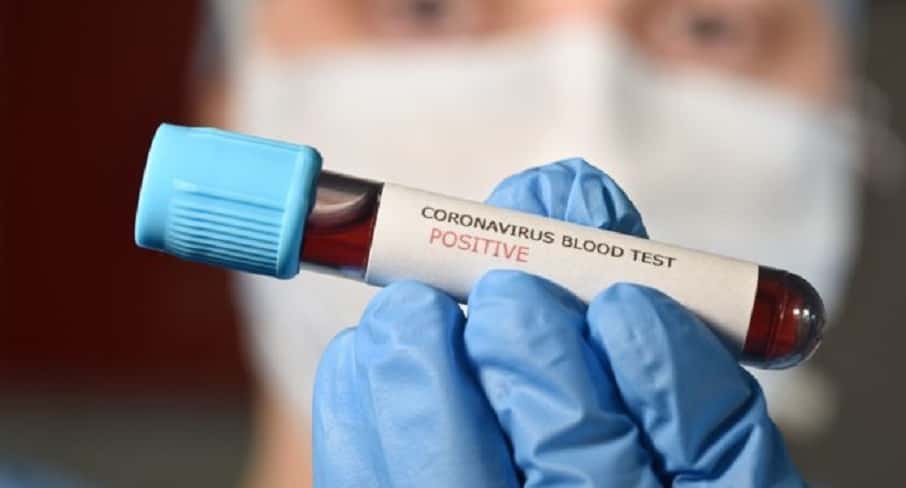 Este miércoles se registraron seis nuevos casos de coronavirus en Entre Ríos