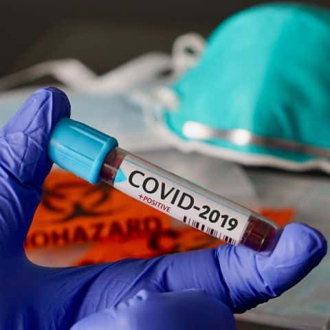 Se registraron 20 nuevos casos de covid-19 en Entre Ríos