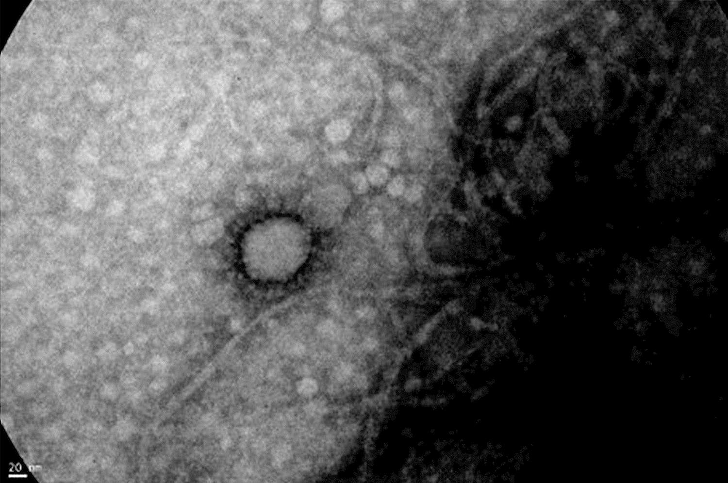 El ANLIS – Malbrán captó la primera foto del nuevo coronavirus que circula en Argentina