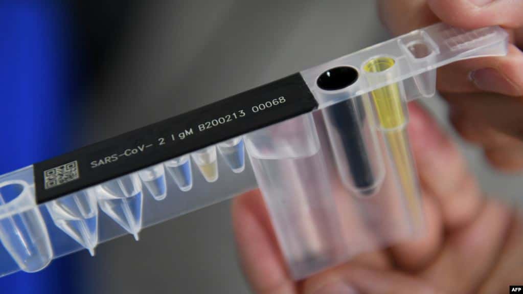 Coronavirus: ¿Son confiables los test de inmunidad?