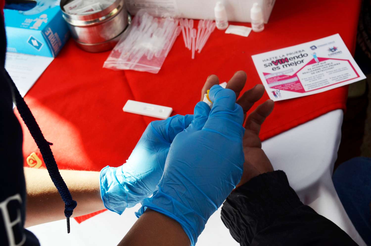 La pandemia de Covid19 puede echar por tierra los avances contra el VIH