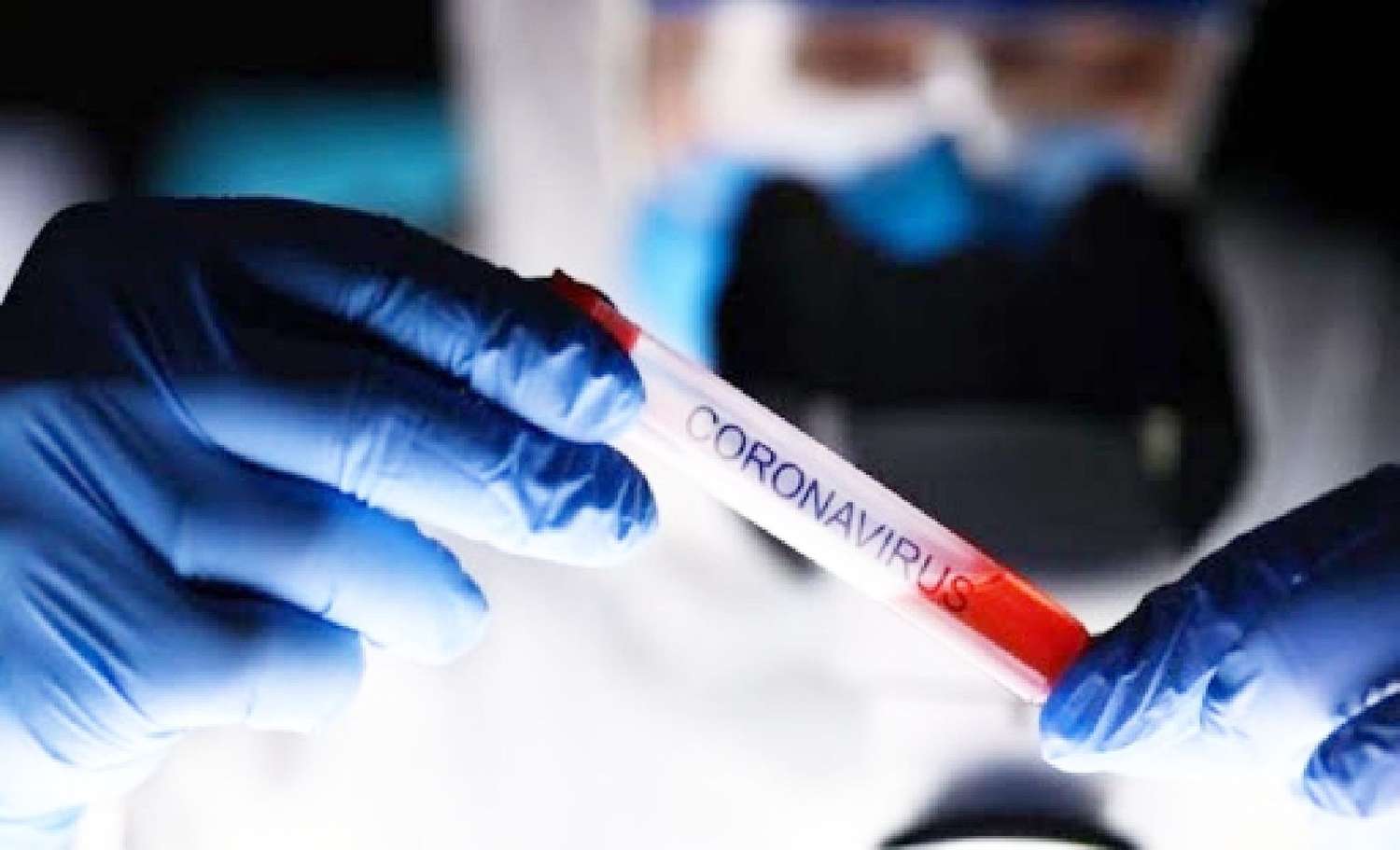 En Entre Ríos se han sumado 63 nuevos casos de coronavirus