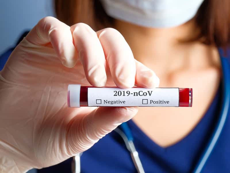 Se registraron otros 121 casos de coronavirus en Entre Ríos