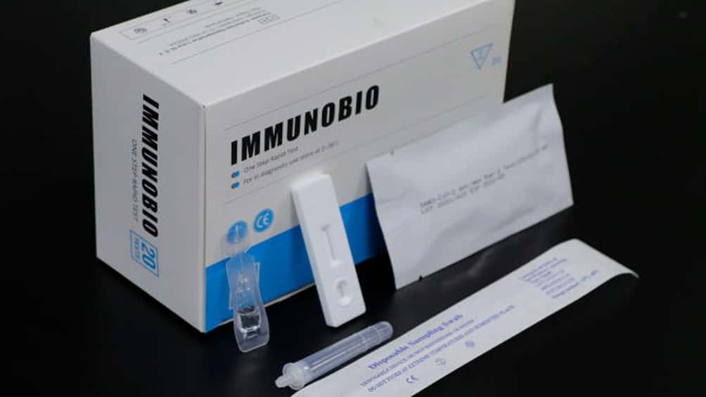 La Anmat aprobó un test rápido de coronavirus que ya se vende en farmacias